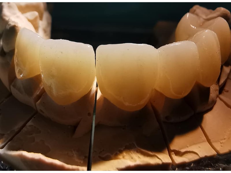 Zirconiu