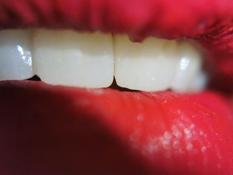 Zirconiu
